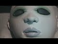FACE TRANSPLANT