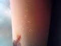 EMMANUEL CORTANDOSE EL BRAZO EMMANUEL CORTANDOSE EL BRAZO