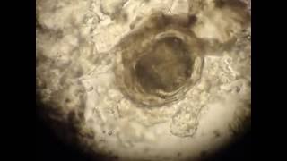 "METACERCARIA DE Clinostomum complanatum EN TEJIDO MUSCULAR DE PECES CÍCLIDOS DE LA PRESA Franc