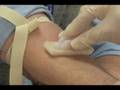 NASA research may help weak patients