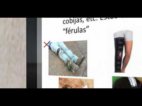 Fracturas