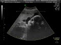 our 29 weeks baby's 4d ultrasound