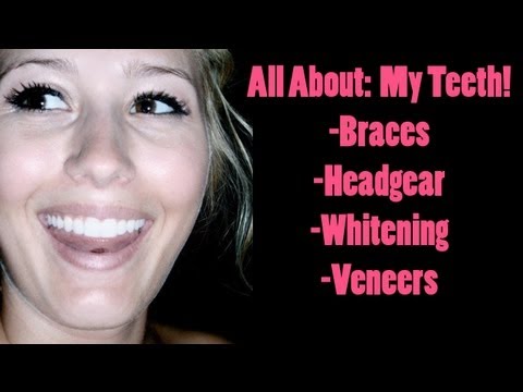 how to whiten teeth if you have veneers