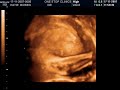 4d Scan of Leo James Fulcher