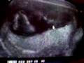 videos de chucho en la guata