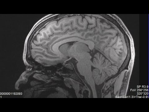 how to assess a concussion