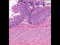 Shotgun Histology Recto-Anal Junction