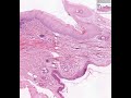 Shotgun Histology Recto-Anal Junction