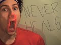 Jeremy Fisher - Scar That Never Heals