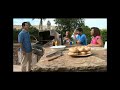 Dr. Andrew Villa of New Horizons Women's Care Essure Procedure Commercial