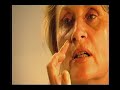 Fibroblast transplanting: RTE interviews Dr. Treacy Fibroblast transplanting: RTE interviews Dr. Treacy