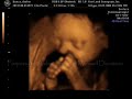 Our Sweet Baby at 25 Weeks!!! *UPDATED*