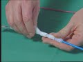 stent retrieve