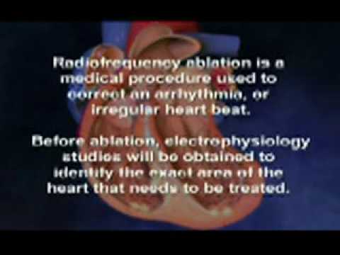 how to cure irregular heartbeat
