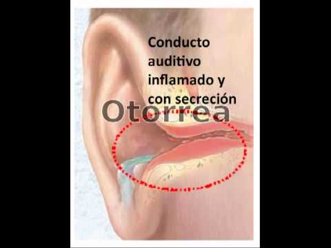 Imatge de previsualització de YouTube