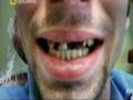 videos de La droga mas peligrosa del mundo - crystal - meth - parte 2 de 6
