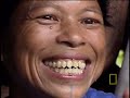teeth chiseling