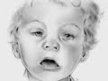 Fetal Alcohol Syndrome PSA Fetal Alcohol Syndrome PSA