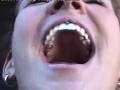 A hot woman shows her tooth filled with amalgams