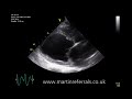 Visit http://www.vetsurgeon.org for a full description of this video.