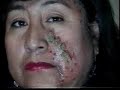 Moxibstion Video20 Moxibstion Video20