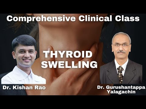 Thyroid Swelling Case Presentation
