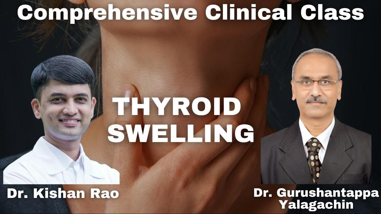Thyroid Swelling Case Presentation