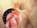 Medical Illustration by Hector Aiza - YouTube