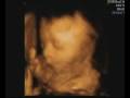 4DScan