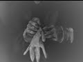 Cadaveria Verminose Cadaveria Verminose
