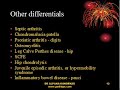 juvenile rheumatoid arthritis juvenile rheumatoid arthritis