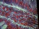 small intestine small intestine