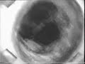Video ispezione canna fumaria in eternit
