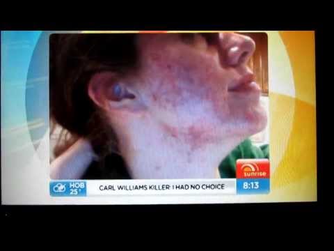 Cassandra's video