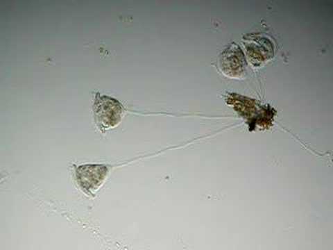?????? Vorticella
