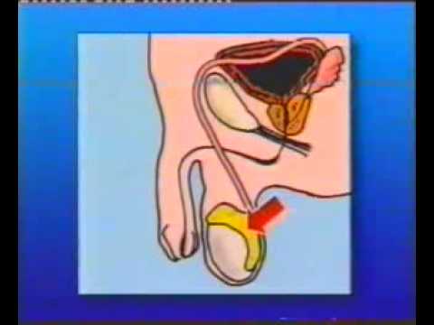 how to testicular self exam