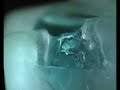 212 on ice