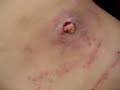 an extra hole?