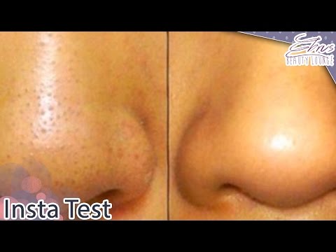 Quick Test: Mitesser ade? / Ebru's Beauty Lounge
