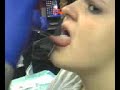 Tongue Piercing PART 1