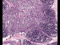 Shotgun Histology Thymus