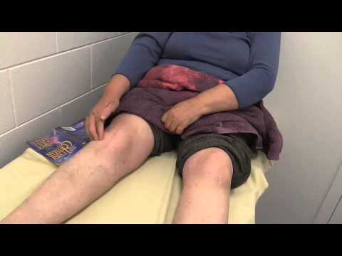 how to relieve pain after tkr