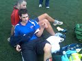 Dislocated Knee Cap