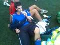 Dislocated Knee Cap