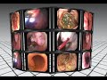 Gastrointestinal Endoscopy