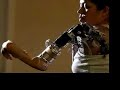 prosthetics