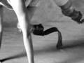 prosthetics