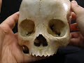 922-125FD Female Skeleton - Disarticulated 922-125FD Female Skeleton - Disarticulated