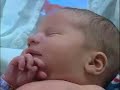 Magnesium Sulfate Reduce Cerebral Palsy Risk in Preemies Magnesium Sulfate Reduce Cerebral Palsy Risk in Preemies