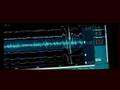 Nemzet Aranya 2. Magyar Trailer